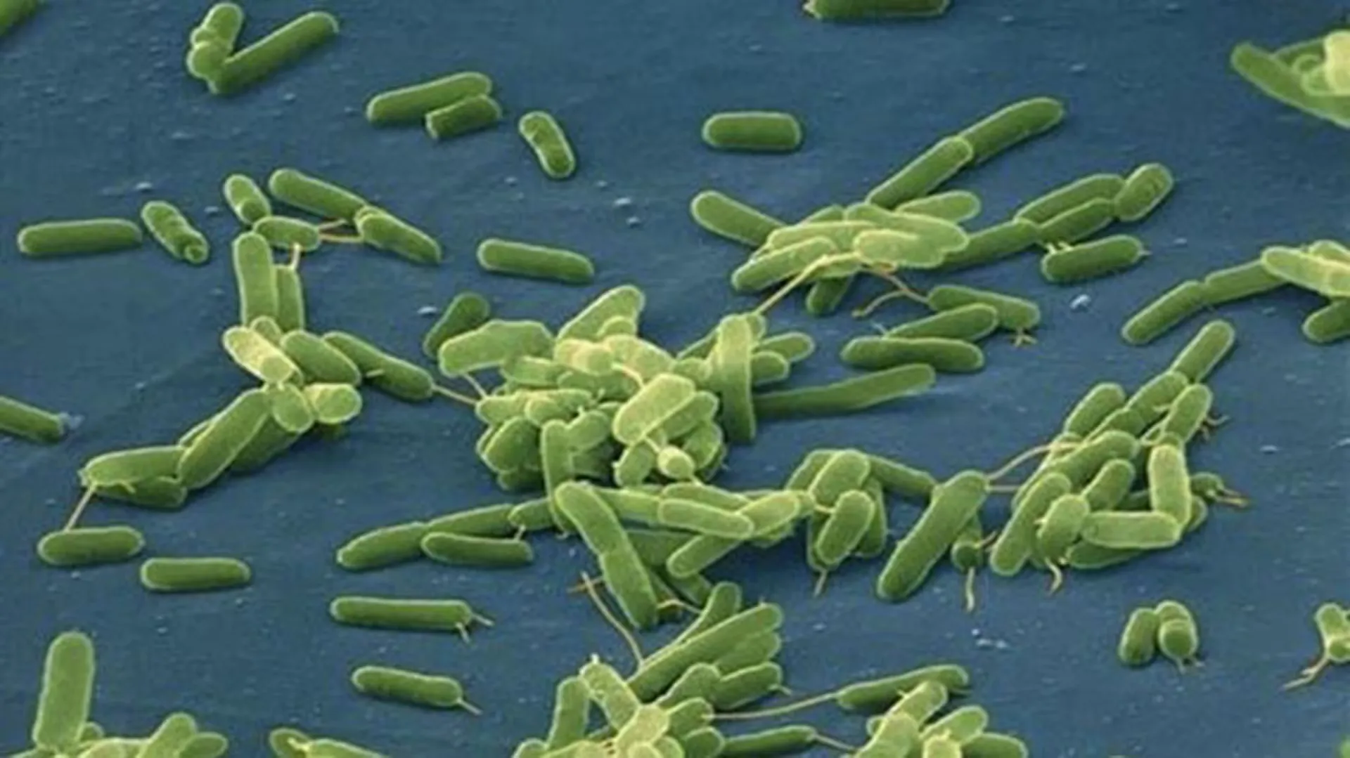 Florida registra la primera muerte por bacteria carnívora de 2026