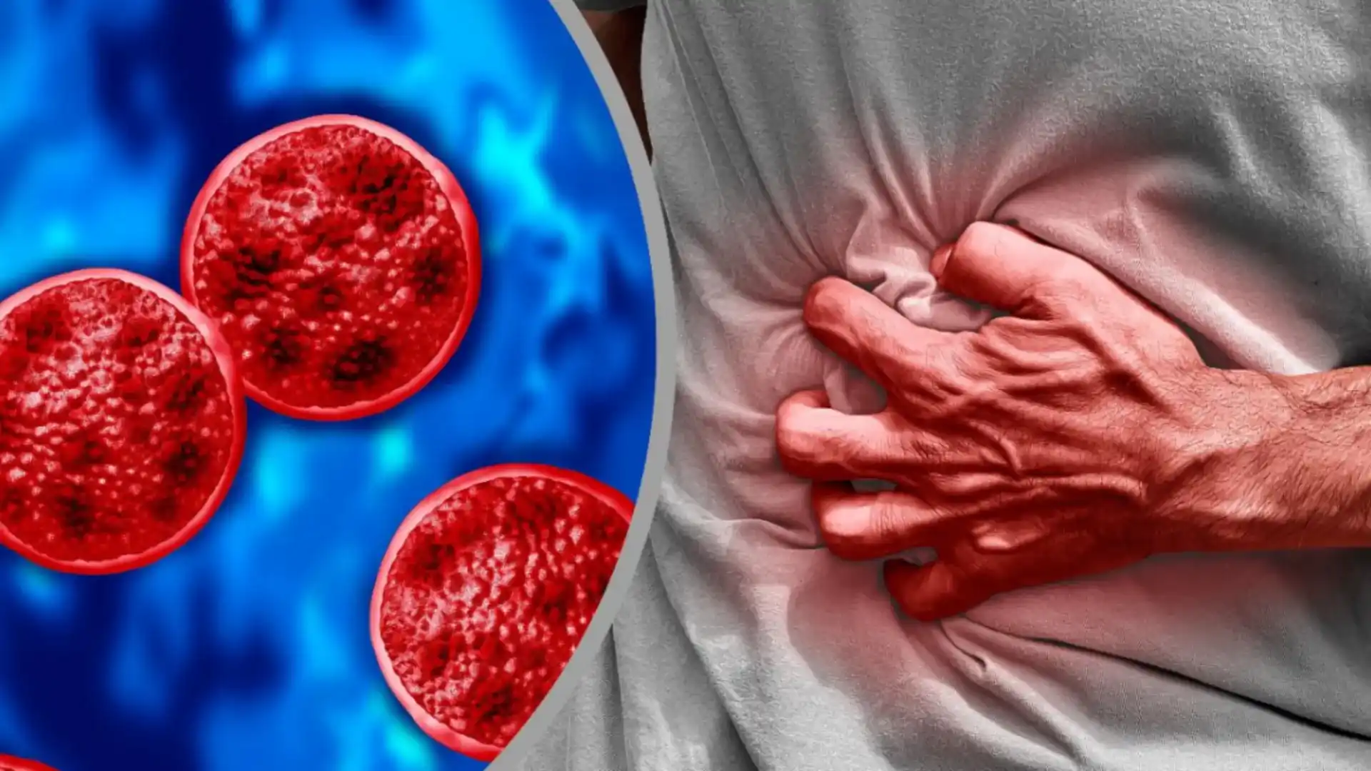 Se han reportado las primeras muertes en el brote de ciclosporiasis. 11zon