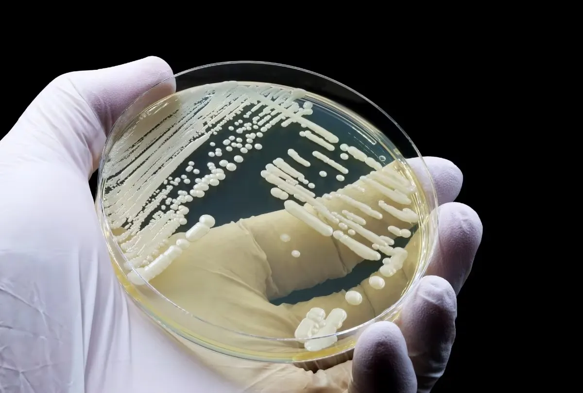 Infección por hongos resistentes a los medicamentos se está propagando en Arizona y otros estadoswebp