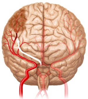 cerebro